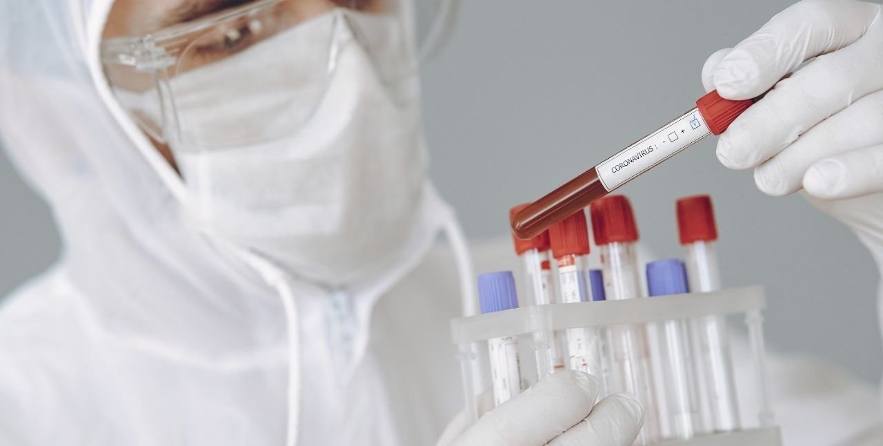 Salud Pública reporta otros 499 casos de coronavirus y suman 2,088 este fin de semana