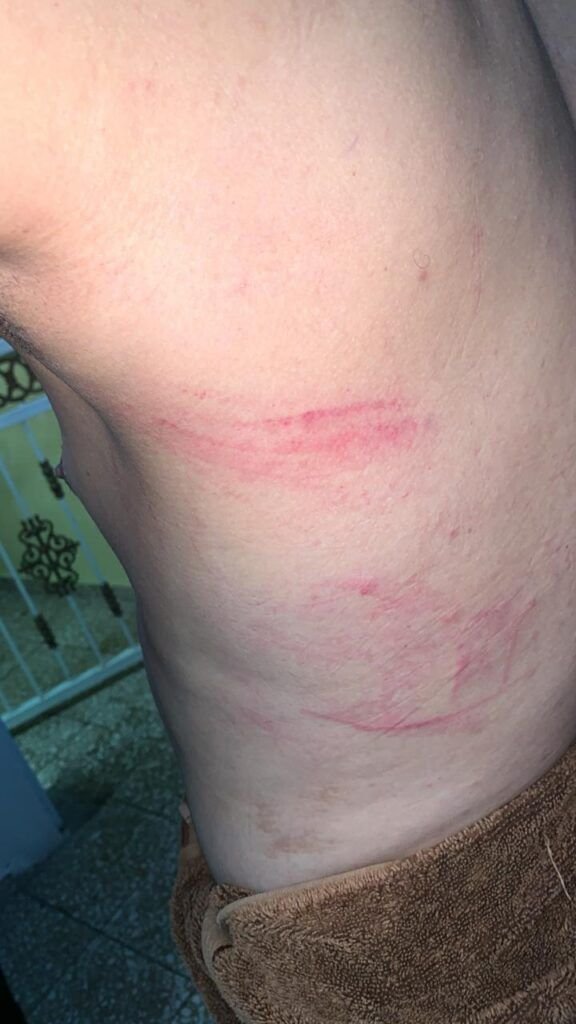 Oficial EN 01 Video | Policías agreden Oficial del Ejército en su propia casa en Los Mameyes