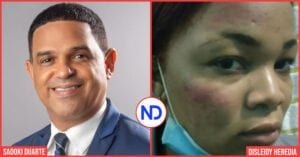 Acusan diputado PRM de golpear una mujer raso de la PN en Cotuí