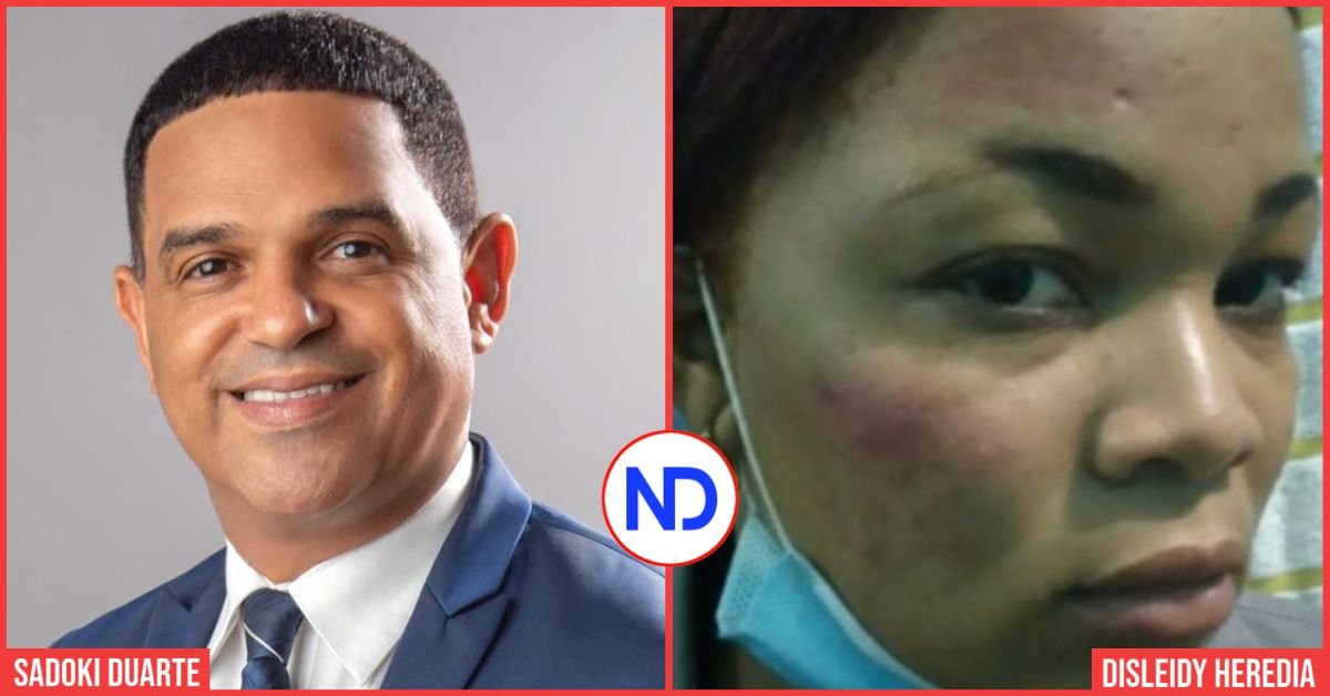 Acusan diputado PRM de golpear una mujer raso de la PN en Cotuí