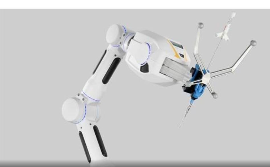 Un brazo robótico solidario contra tumores encefálicos