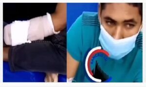 San Cristobal: Delincuentes mutilan mano a joven con condición especial