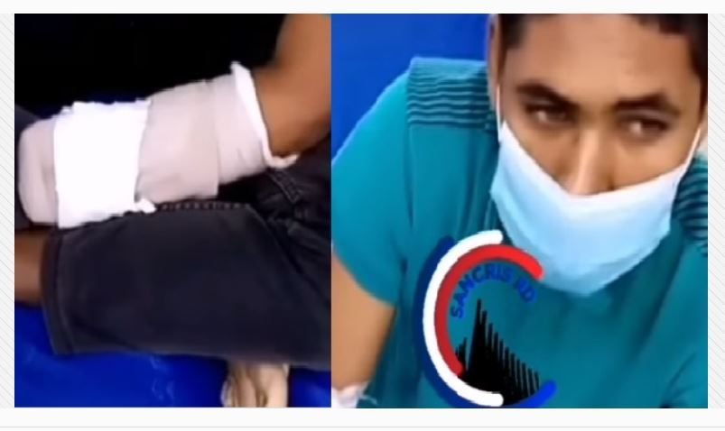 San Cristobal: Delincuentes mutilan mano a joven con condición especial