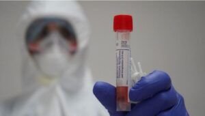 Importación y comercialización pruebas covid deberán ser autorizadas