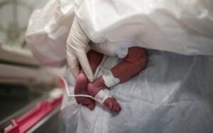 Muere un bebé de dos meses a causa de covid en Venezuela