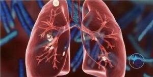 Estudio avala nueva vacuna contra la tuberculosis