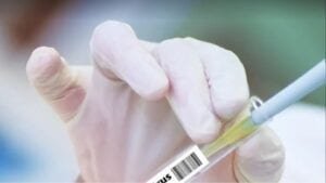 Tres muertes y 379 nuevos contagios de COVID-19 en el país