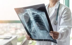 ¿Sabía que la neumonía por Covid a veces no avisa?