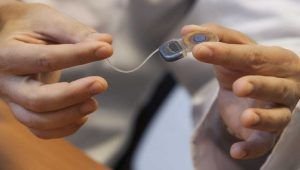 Otorrinos del H. Gautier buscan devolver audición a sordos con trasplante coclear