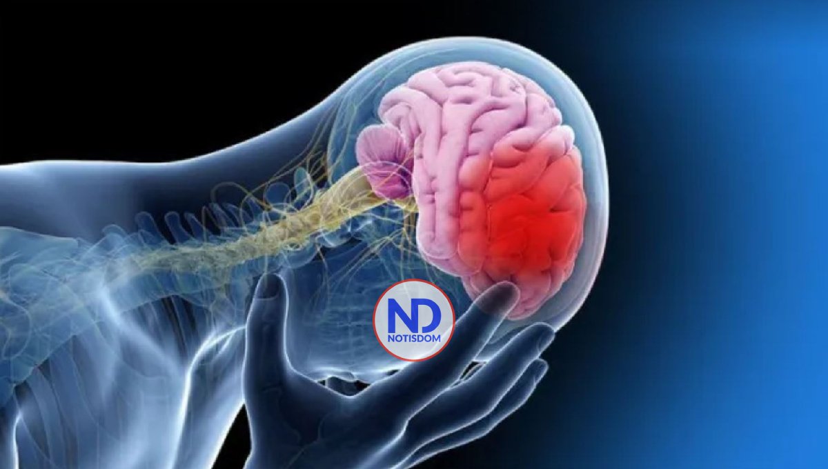 Conmemoran Día Mundial del Ataque Cerebrovascular 2 Conmemoran Día Mundial del Ataque Cerebrovascular