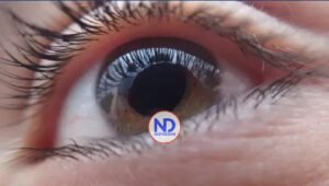 Un medicamento para el alcoholismo ayuda a tratar la ceguera