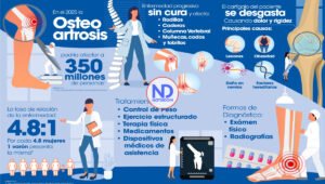 Osteoartrosis, una de principales causas de discapacidad en mundo