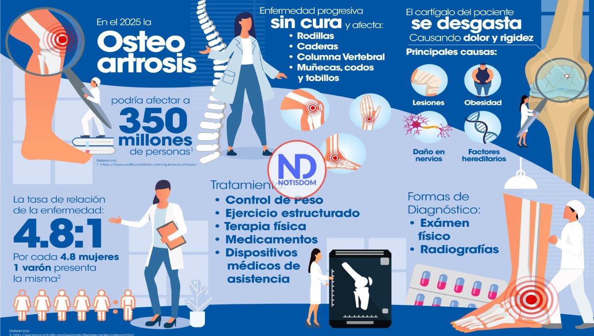 Osteoartrosis, una de principales causas de discapacidad en mundo