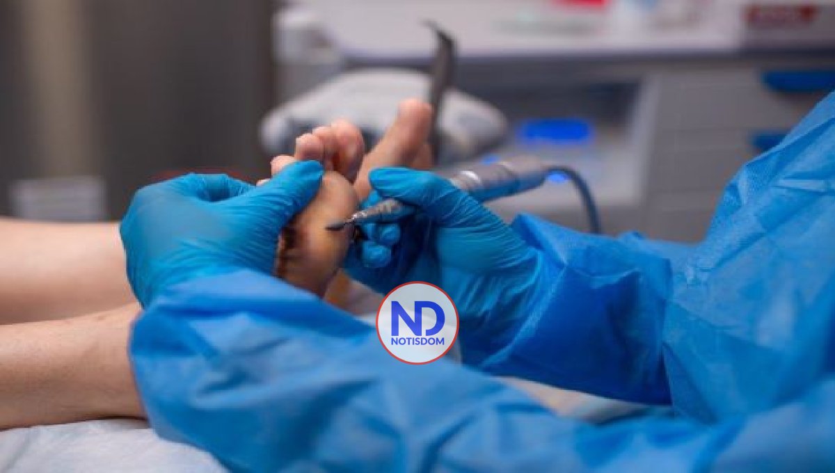 Sugieren control de la diabetes y cuidado de los pies 2 Sugieren control de la diabetes y cuidado de los pies