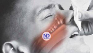 Libérate de los pólipos nasales con láser