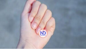 Cuando el aspecto de las uñas nos avisa de algunas enfermedades