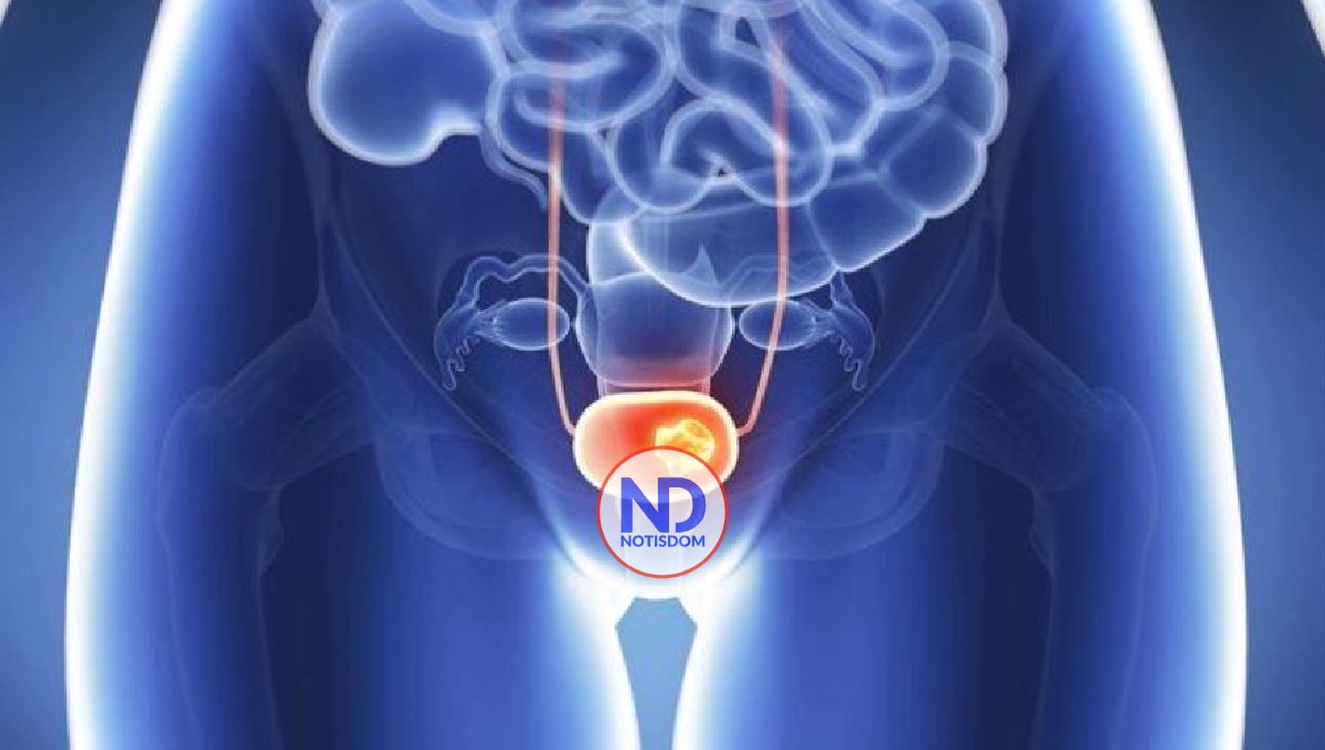 Oncóloga afirma cáncer de cérvix es altamente prevenible y tratable