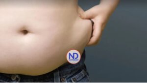 El 70 % de personas con obesidad en Latinoamérica no están diagnosticadas