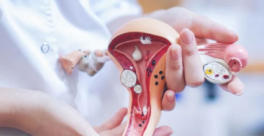 MIOMAS 1 Mioma uterino: qué es y algunos de sus síntomas