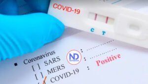 Salud Pública reporta 874 nuevos casos por covid