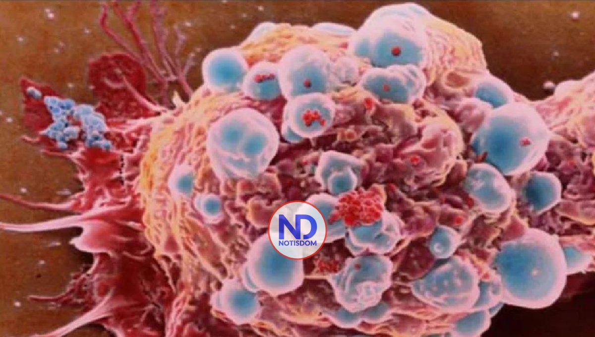 RD tendría 64,5 % más casos de cáncer en el 2040