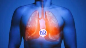 Cáncer pulmón se detecta como la gallinita ciega, dicen neumólogos