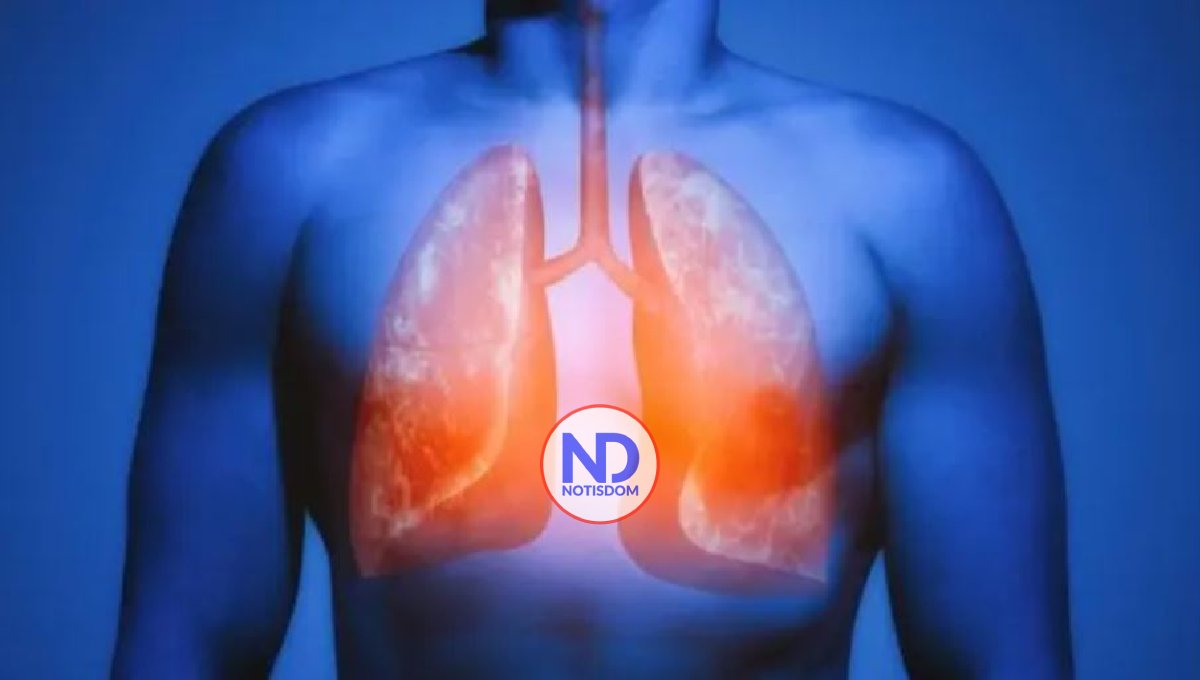 Cáncer pulmón se detecta como la gallinita ciega, dicen neumólogos