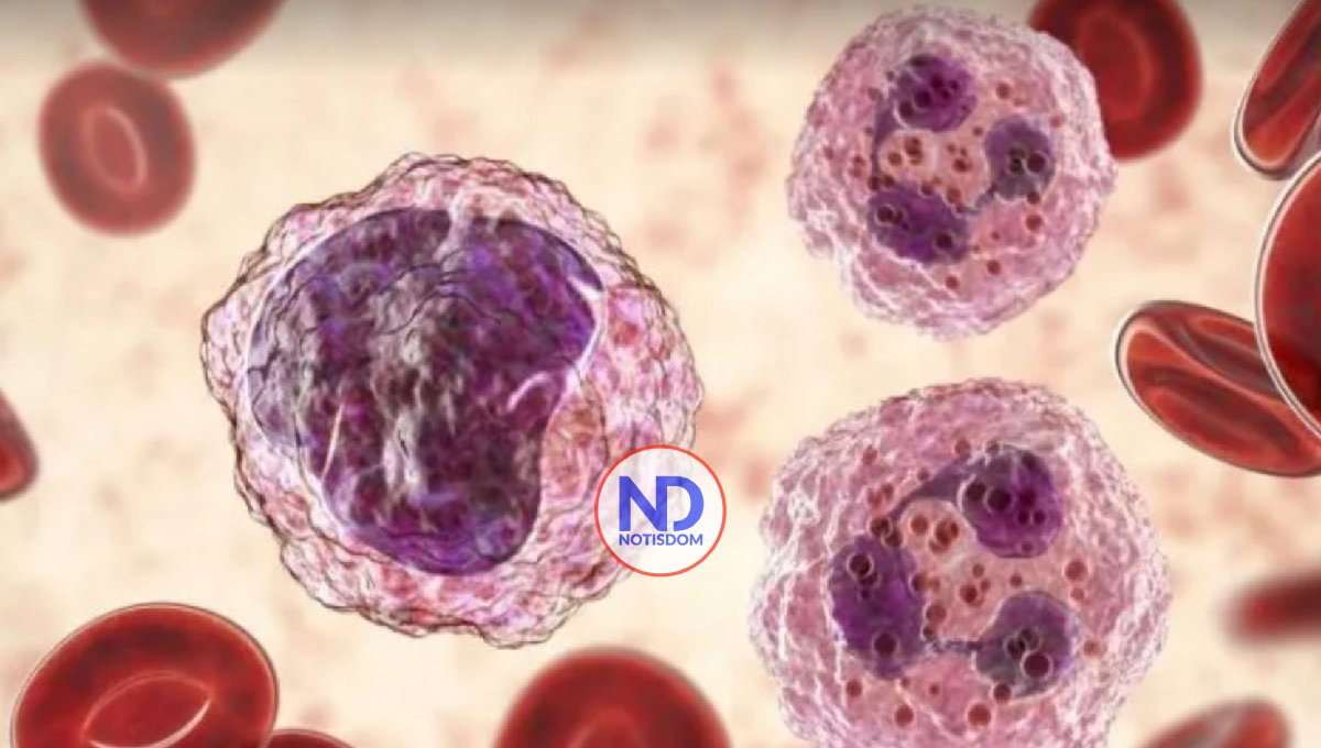 Descubren células ocultas que pueden provocar recaídas en la leucemia