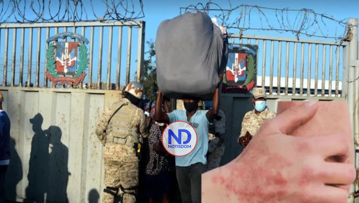 Haitiana en Dajabón presenta síntomas de infección cutánea