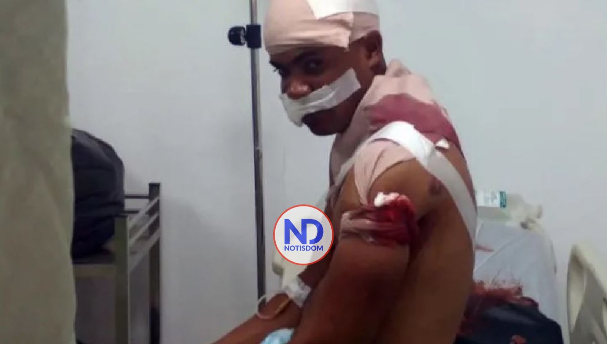 Haitianos hieren de cuatro balazos a militar RD custodiaba la frontera