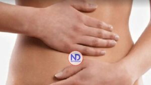 Conoce aquí lo relacionado con una hernia inguinal