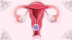 Cáncer de Ovarios: a partir de los 50 años el riesgo de padecerlo aumenta un 11%