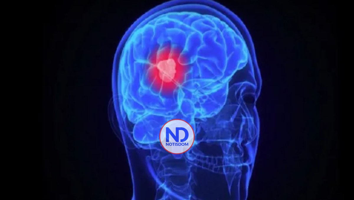 Hoy se conmemora el Día Internacional de los Tumores Cerebrales