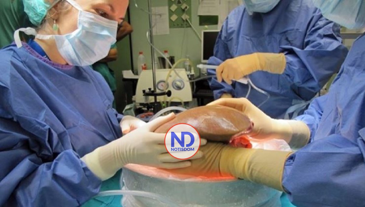 Exitoso trasplante hígado humano tratado 3 días fuera del cuerpo