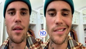 Justin Bieber recupera la sonrisa tras meses con parálisis facial
