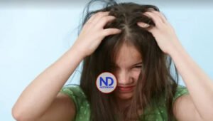 Pasos para tratar los niños con piojos