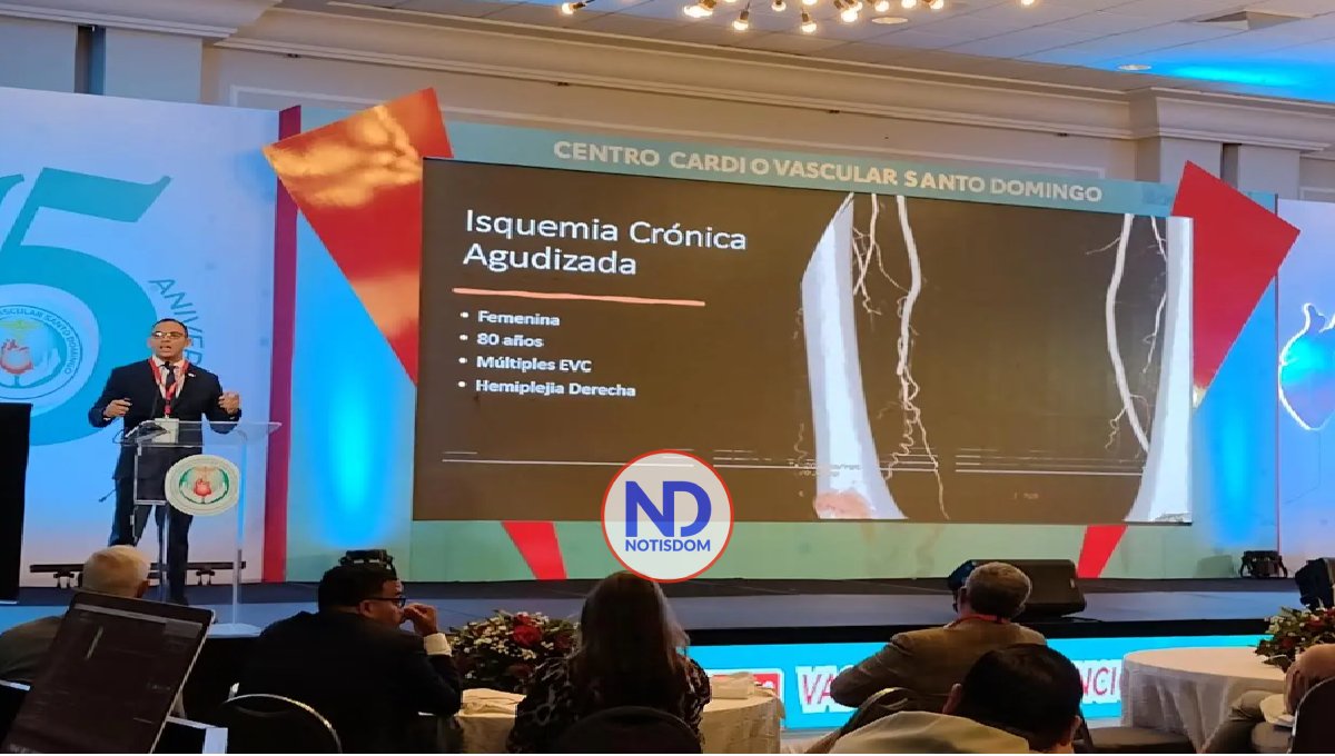 RD cuenta con última generación para limpiar venas y prevenir ACV e infartos