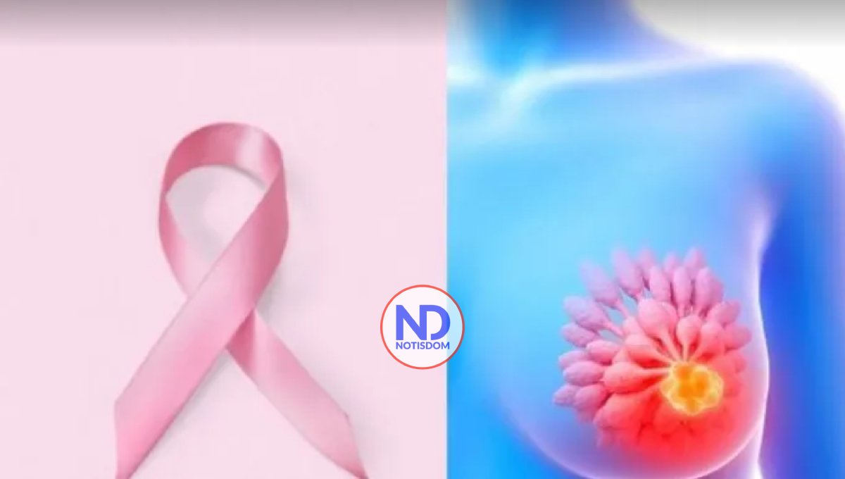 Un fármaco muestra eficacia contra metástasis cerebral en cáncer de mama