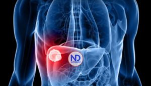 Día Mundial contra la Hepatitis Vírica