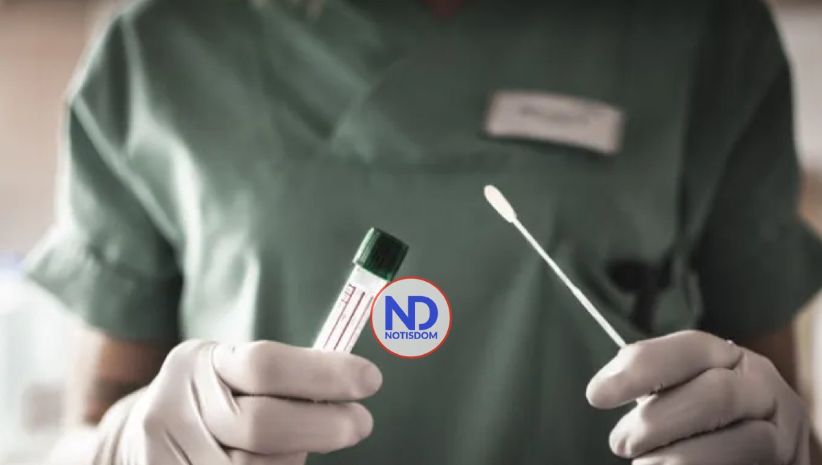 Enfermedad Utilizan método PCR para determinar positividad de viruela del mono