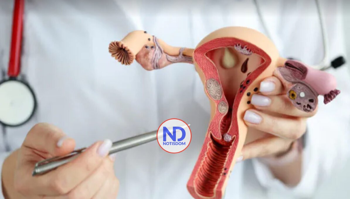 Doctora, ¿es normal que una tenga la regla de color oscuro? 2 Doctora, ¿es normal que una tenga la regla de color oscuro?