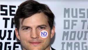 Actor Ashton Kutcher a punto de perder la vista y el oído