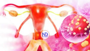 Cáncer va en aumento, asegura Sociedad de Oncología