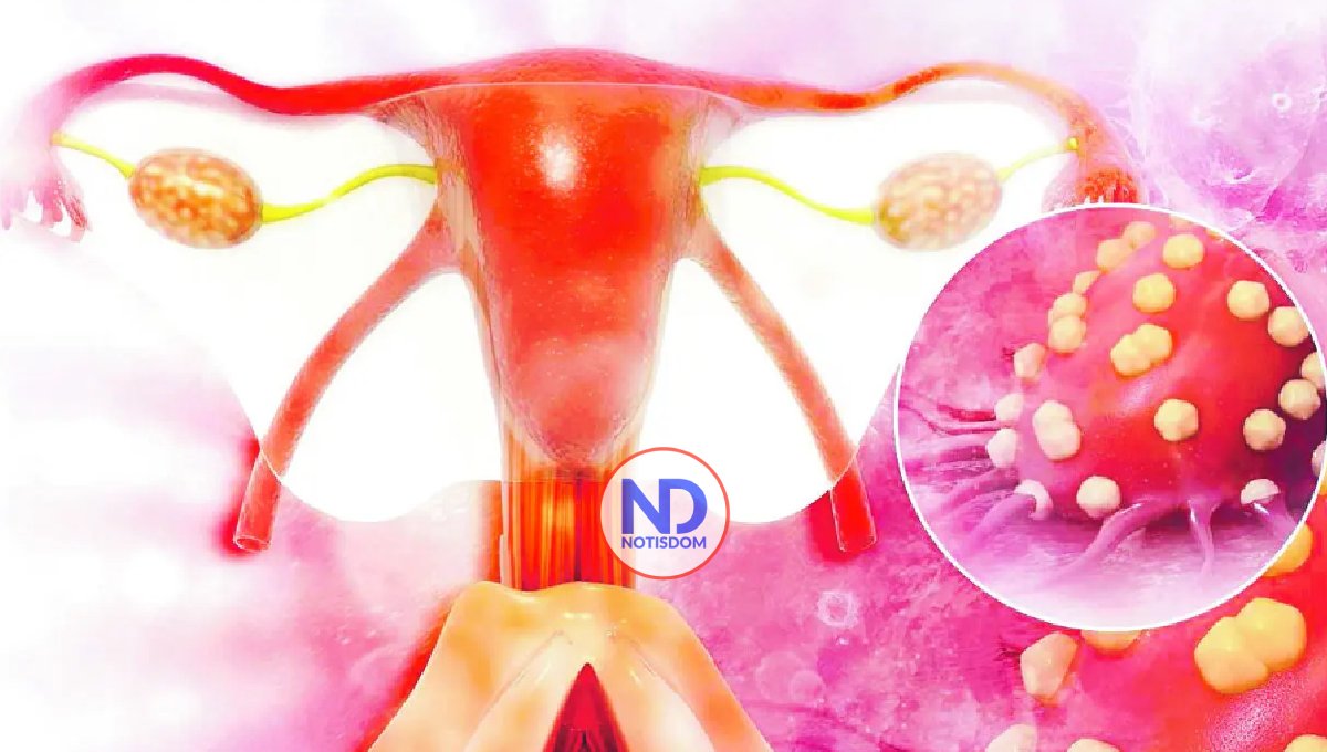 Cáncer va en aumento, asegura Sociedad de Oncología