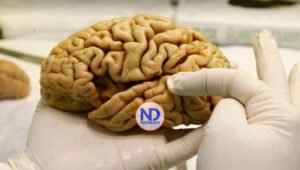 Ventajas y desventajas de los cerebros de personas creativas, según la ciencia