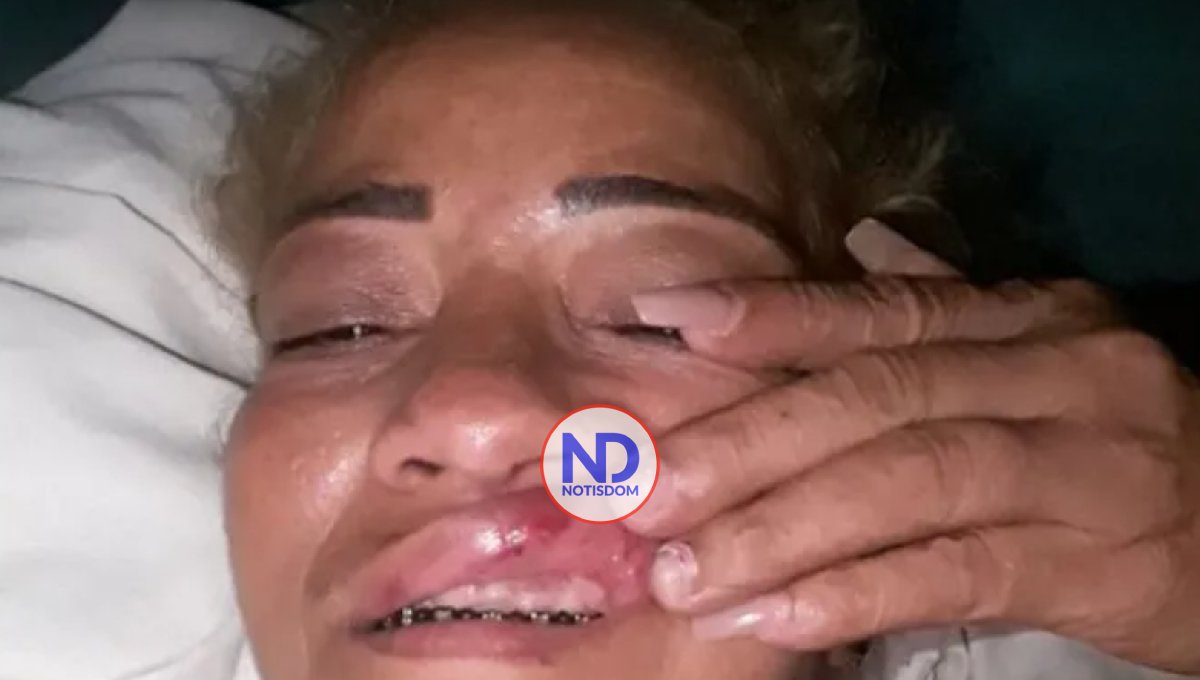 Mujer denuncia expareja intentó matarla con un puñal en Montecristi