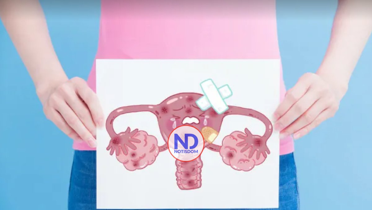 ¿Se puede quedar embarazada con ovario poliquístico?