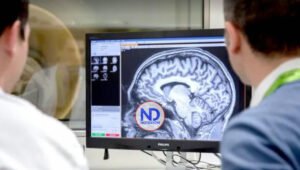 Infecciones hospitalarias elevan el riesgo de padecer Alzheimer y Parkinson