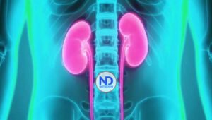 Enfermedad de cambios mínimos: ¿Qué es y cómo afecta el organismo?