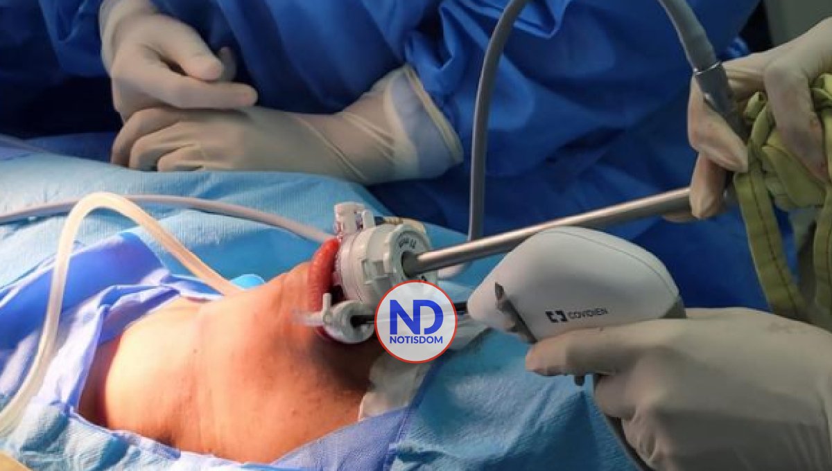 Nueva técnica para extirpar la tiroides se aplica en el país